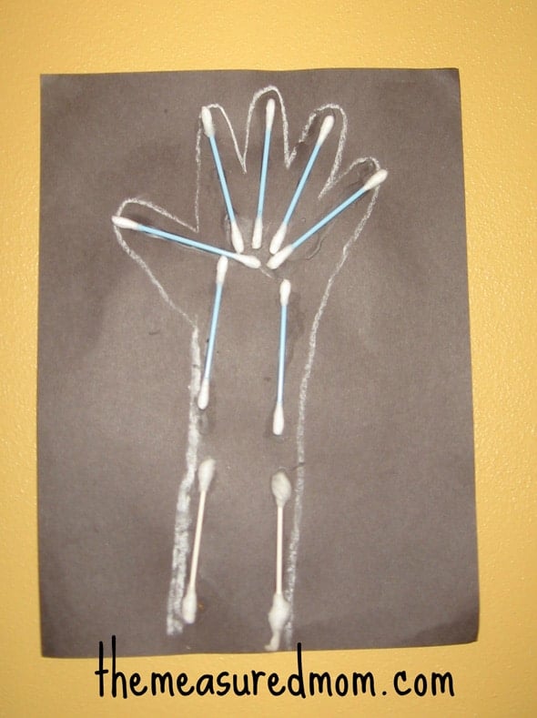 Q-tip X-ray letter X